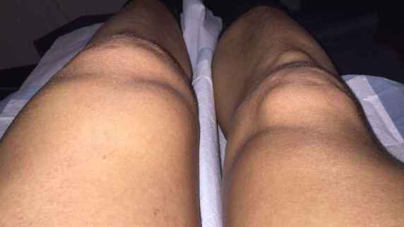 riewoldt knee 1
