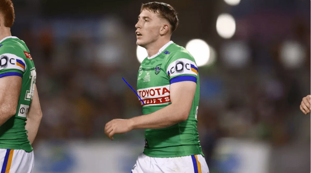 The Impact of the Matty Nicholson&nbsp;Injury
